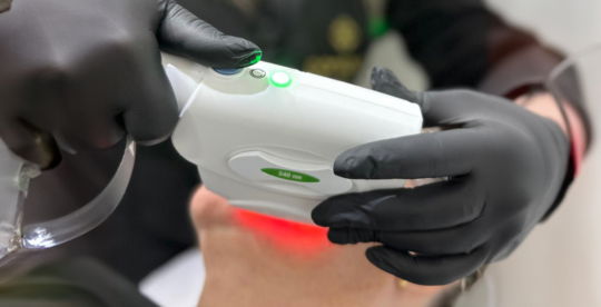depila-o-a-laser.jpg